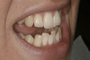 Orthodontics 1