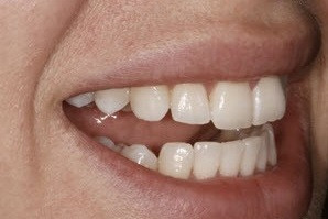 Orthodontics 2